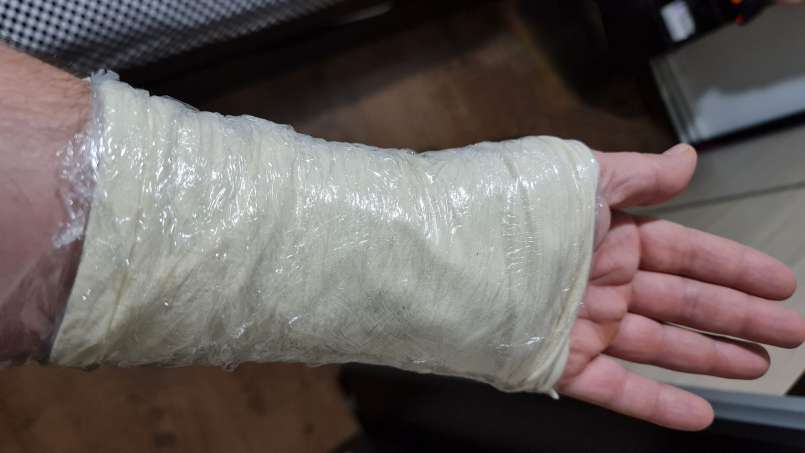 Cataplasma com folhas de repolho e loys, foto 8